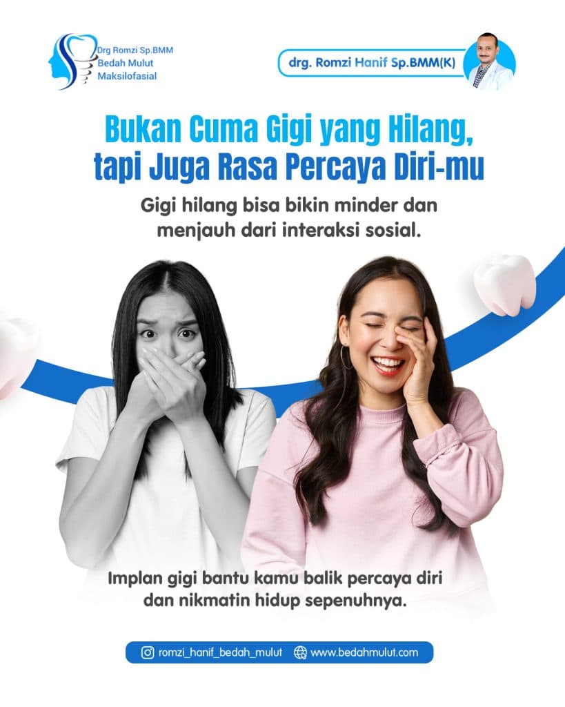 Lebih dari Sekadar Estetika: Mengapa Gigi Hilang Bisa Mengikis Rasa Percaya Diri Anda?