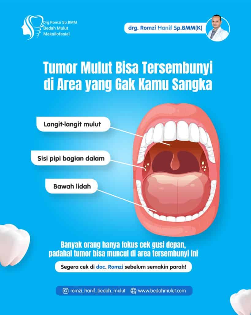 Tumor Mulut Bisa ‘Sembunyi’ di Mana Saja—Gak Cuma di Gusi Depan Lho!