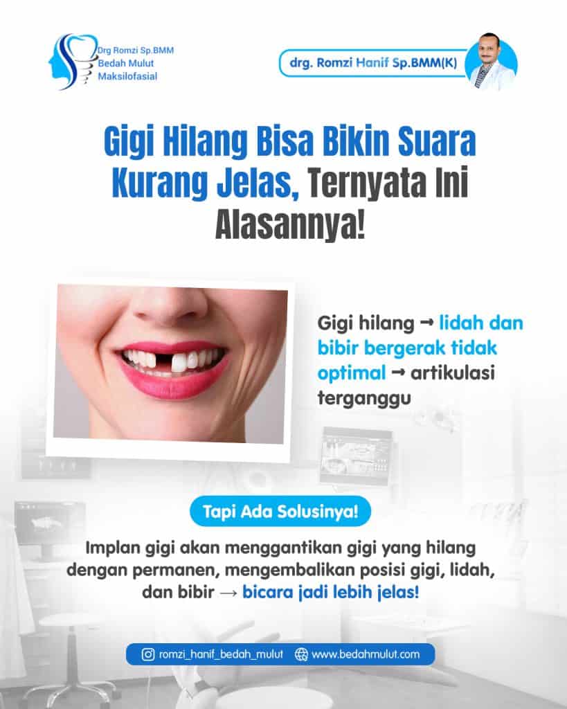 Lebih dari Sekadar Senyum: Rahasia di Balik Suara Jelas dan Deteksi Dini Masalah Mulut yang "Sembunyi"