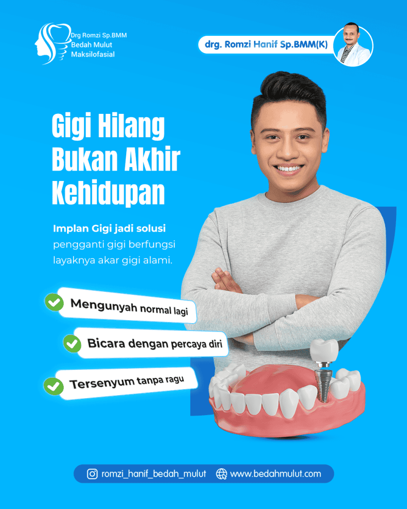 Gigi Hilang Bukan Akhir Segalanya: Mengembalikan Senyum dan Kualitas Hidup dengan Implan Gigi