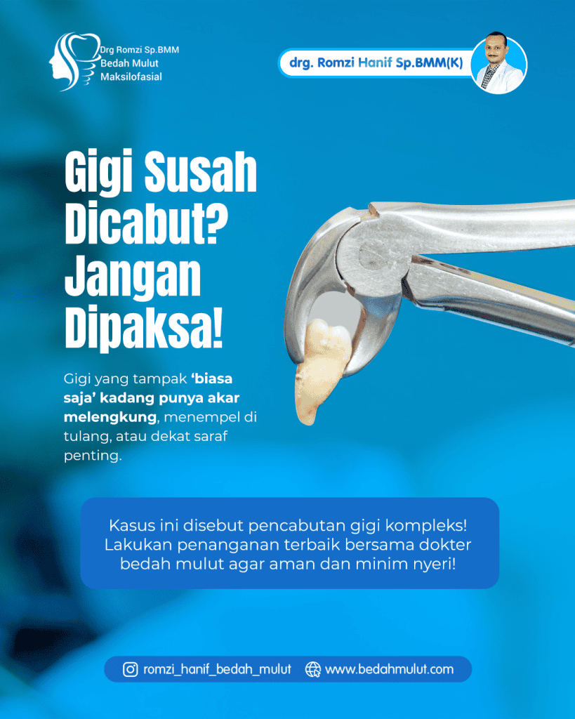 Gigi Susah Dicabut? Jangan Dipaksa! Mengenal Pencabutan Gigi Kompleks dan Pentingnya Penanganan Spesialis