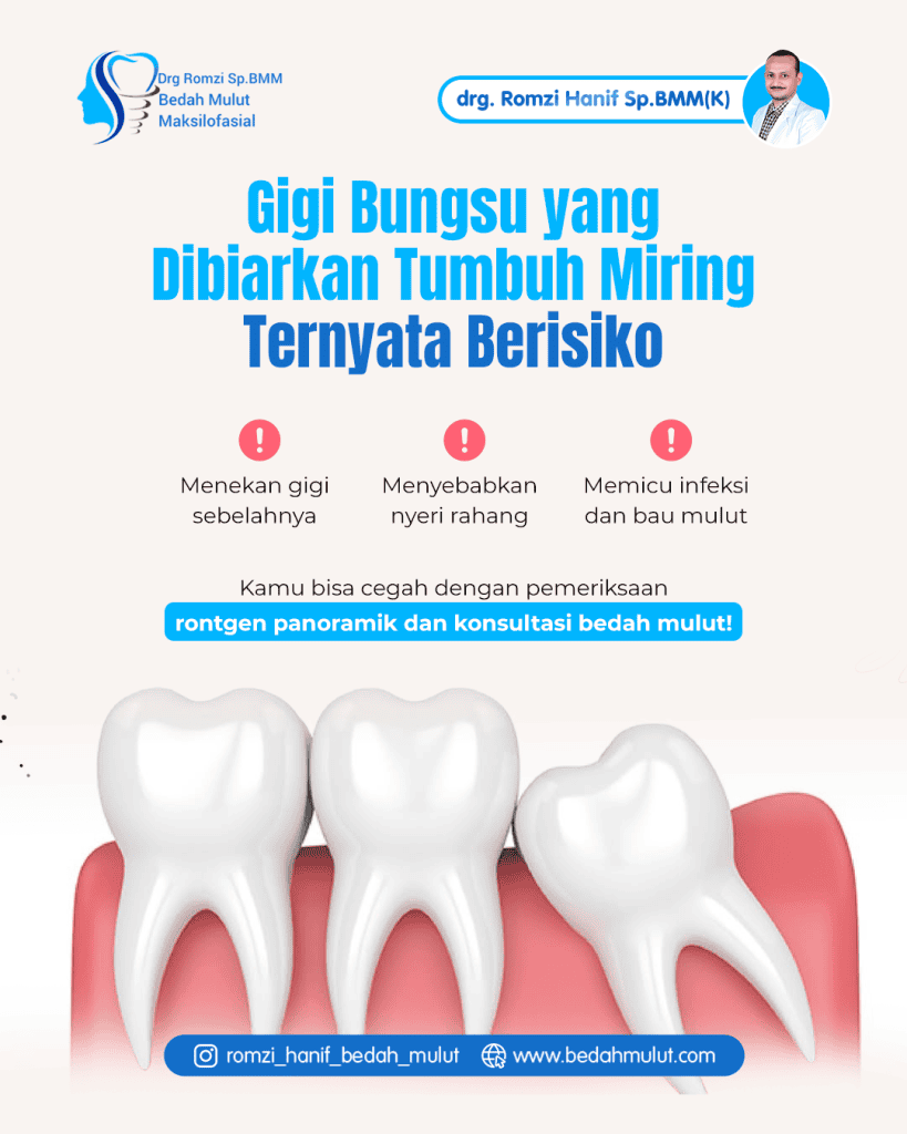 Gigi Bungsu Miring: Cuma Nyeri Biasa atau Bom Waktu? Yuk, Bedah Tuntas Bareng Doc Romzi!