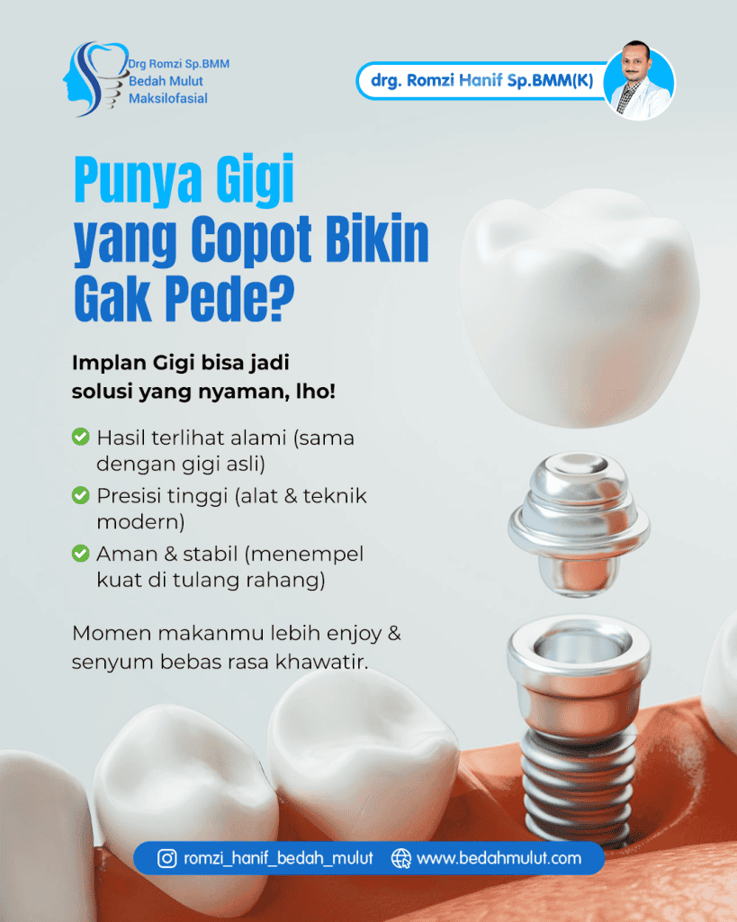 implan drg romzi